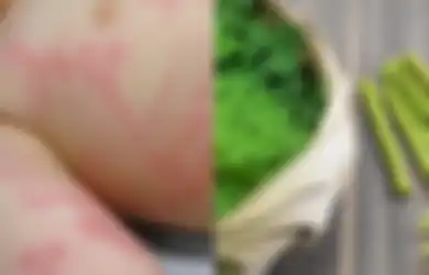 Coba Obati Biduran dengan Antihistamin Alami Termasuk Daun Kelor