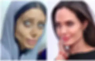 Dulu Sangat Viral Wajahnya Hancur Total Gara-gara Oplas Supaya Mirip Angelina Jolie, Wanita Ini Kini Nasibnya Sungguh Mengenaskan, Meringkuk di Penjara Sambil Menderita Covid-19