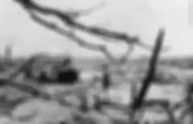 Sudah Tua dan Lansia, Nyatanya Para Korban 'Ringan' Bom Atom Hiroshima Ini Tidak Pernah Mendapat Akses Kesehatan Gratis dari Pemerintah Tidak Seperti Korban Lainnya, 'Padahal Sudah 75 Tahun!'