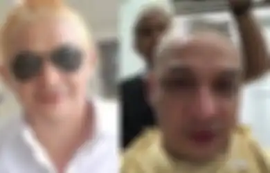 Pasha Ungu Langsung Kicep Saat Rambut Kuningnya Kena Tegur Mendagri, Istri Adelia Wilhelmina Berikan Pembelaan Ini Ketika Disinggung Soal Kepala Botaknya: Tidak Etis!