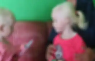 Beda Jauh, Jika Anak Kembar Albino di Wonogiri Viral dan Sering Diajak Swafoto, di Tempat Ini Orang-Orang Albino Diburu, Dibantai, dan Diambil Organnya untuk Ilmu Sihir