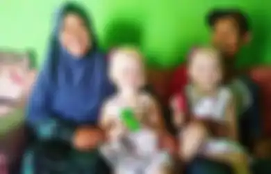 Pulang Kampung ke Wonogiri, 2 Balita Kembar Ini Langsung Viral karena Lahir Albino Bak Anak Bule, Sang Ibu Bahagia Campur Cemas: Nanti Kalau Besar Gimana, kan Berbeda...