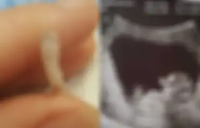 Kisah Seorang Ibu yang memilih Menyimpan Jasad Bayinya di Dalam Kulkas Selama Seminggu, Ada Fakta Pilu Dibalik Tindakannya