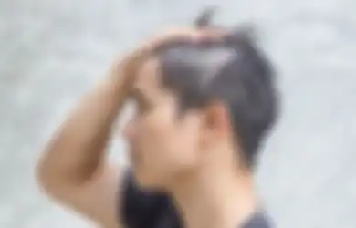 Apa Benar Efek Tekanan Stres Bikin Rambut Lo Jadi Beruban? Simak Penjelasannya
