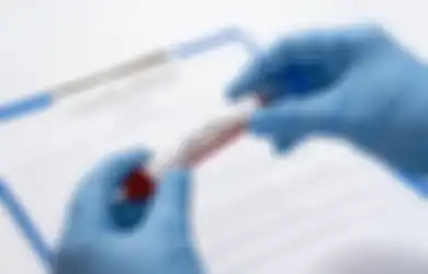 Kabar Baik Setelah Setahun Lebih Negara-negara di Dunia Dilanda Pandemi, Ahli Sebut Kelemahan Virus Covis-19 Ada di 3 Hal Ini, Salah Satunya Suhu Panas!