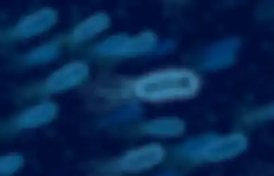 Belum Selesai Wabah Covid-19, 6000 Warga di Barat Laut China Positif Terinfeksi Bakteri Brucellosis, Begini Gejala Awalnya