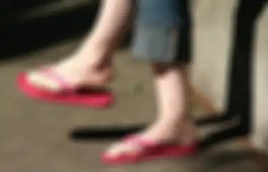 4 Bahaya Terlalu Sering Pakai Sandal Jepit Bagi Kesehatan Kaki. Jangan Diabaikan!