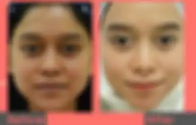 Lesti Kejora Tuai Hujatan Netizen Gegara Makin Cantik, Inul Daratista Beri Pesan Menohok