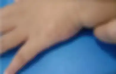 Duh, Kok Bisa Ya? Ada Cacing Hidup di Bawah Kulit Anak Anji, Ini Penyebabnya Salah Satunya Sering Dilakukan oleh Anak-anak