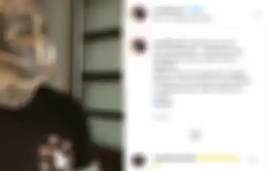 Bikin Geleng Kepala, Cowok Ini Pengen Jadi Monster Sampe Ubah Gigi Mirip Gading