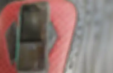 Ngeri, Tubuh Pria Ini Terbakar Saat Tidur dan Simpan HP di Bawah Bantal!