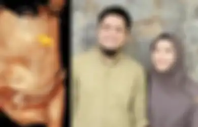 Oki Setiana Dewi Akan Jalani Operasi Caesar Hari ini, Lafaz Allah di Dahi Sang Anak dalam Foto USG Jadi Sorotan