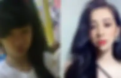 Sakit Hati Sang Pacar Tak Mau Mengakuinya di Depan Teman, Gadis Ini Jalani Operasi Plastik Setelah Putus