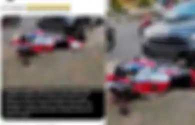 Insiden Mobil Daihatsu Ayla Seruduk Motor CBR 1000RR Berakhir Damai, Korban Tak Tega Terima Ganti Rugi dari Si Pelaku karena Kondisi Istrinya yang Hamil 6 Bulan: Saya Cuma Patah Tulang