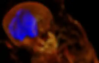 Temukan Mumi Mesir Kuno Berusia Ribuan Tahun, Peneliti Keget Bukan Ketika Melakukan Scan Pada Tubuhnya Menemukan Hal Mengejutkan Ini di Dalamnya