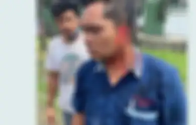 Tiba-tiba Potong Laju Bus, Pengendara Motor di Sidoarjo Nekat Gigit Telinga Sang Kondektur hingga Putus, Ternyata Gara-gara Ini