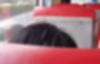 Ngeri, Viral Foto Perempuan dengan Jarum yang Mencuat dari Kepala Naik Bus dengan Santai