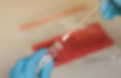 Apa Kelebihan dan Kekurangan Rapid Test Antigen untuk Cek COVID-19?