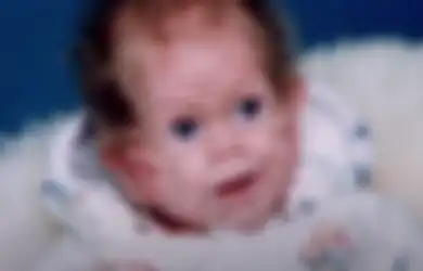 Terlahir dengan Wajah Menyeramkan Masih Bayi Tapi Sudah Keriputan, Tak Disangka Penampilannya Saat Dewasa Justru Mengejutkan Nyaris Tak Memiliki Kerutan di Wajah