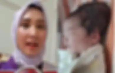 Viral Bayi Lahir dengan Kepala Lonjong Gegara Proses Persalinan Pakai Alat Vakum, Dokter Spesialis Kandungan Minta Bunda Tak Usah Khawatir, Asal...