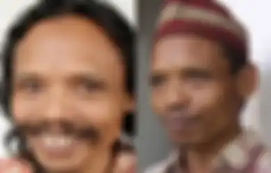Disuntik Vaksin Covid-19, Sumanto si Manusia Kanibal Justru Lontarkan Kalimat Tak Terduga Ini hingga Buat Perawat Bereaksi