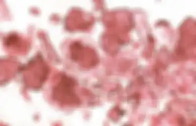 Efek Infeksinya Bisa Rusak Otak hingga Tingkat Kematian 75 Persen, Pakar Mikrobiologi Unair Beberkan Dampak Bahaya Virus Nipah: Berpotensi Bakal Jadi Pandemi Baru