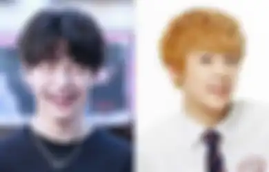 7 Idol KPop Ini Terlihat Imut Pakai Behel Saat Udah Debut. Gemes!