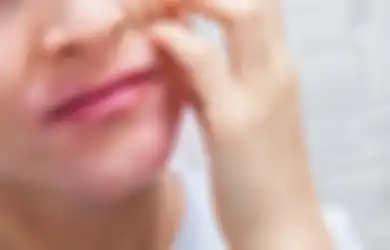 Gatal Digigit Nyamuk? Atasi dengan 4 Bahan untuk Obat Oles Ini!