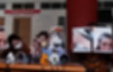 Ungkap Foto KDRT, Nindy Ayunda: Kekerasan itu Sudah Sering Terjadi