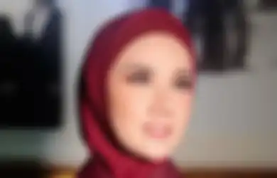 Kecantikannya Sukses Rebut Suami Rekan Duetnya Sendiri, Mulan Jameela Tiba-tiba Posting Wajah Berbintik Putih Penuh Obat, Istri Ahmad Dhani Keluhkan Alis dan Bibirnya