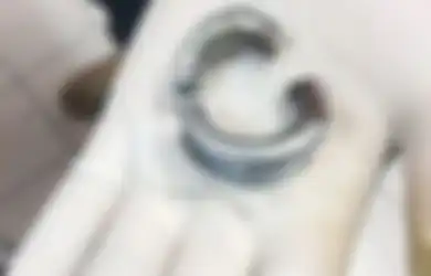 Alat Kelaminnya Dipasangi Cincin Baja Agar Sang Kekasih Terkesima, Pria Ini Bikin Heboh Gegara Rasakan Sensasi Aneh dan Tak Biasa