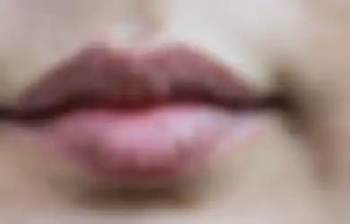 Punya Bibir Pecah-pecah? Ini Dia 5 Cara Alami yang Bisa Kita Lakukan!