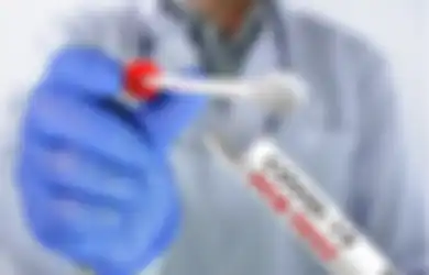 Bukannya Dibuang Malah Dicuci dan Dipakai Lagi, Petugas Medis Kimia Farma di Medan Ketahuan Pakai Alat Swab Antigen Bekas Pakai, Polisi: Kami Temukan Ratusan...