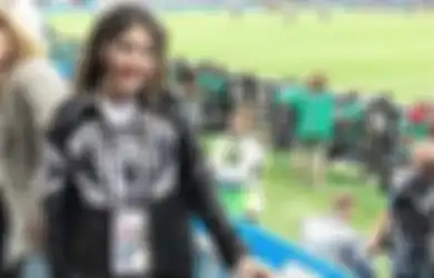 Syok Dituding Operasi Plastik, Via Vallen Malah Dapat Kejutan dari Manchester United, Respons Sang Biduan Disorot