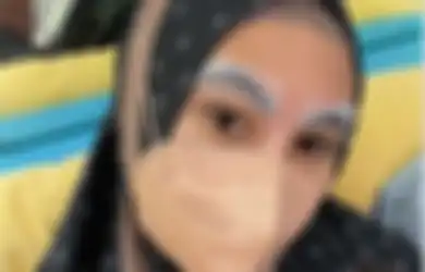 'Kapok, Sudah Seminggu Tak Bisa Buka Mata', Viral Curhatan Wanita Usai Laminating Alis, Bukannya Cantik Malah Bengkak Kemerahan!