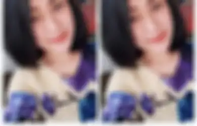 Wajah dan Tubuhnya Dibakar Pria Tak Dikenal Saat Bekerja, Begini Nasib Perawat Cantik Ini Sekarang, Luka Bakar Sampai 60 Persen!