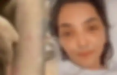 Belum Sembuh dari Penyakit Autoimun, Ashanty Ngaku 2 Bulan Tersiksa karena Gatal-gatal Hingga Tak Bisa Tidur, Istri Anang Hermansyah: Minum Obat Muka Malah Bengkak!