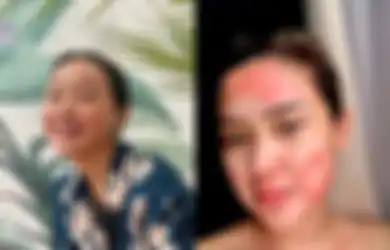 Berbaring dengan Puluhan Jarum di Tubuh, Cita Citata Ungkap Perjuangannya Obati Penyakit Autoimun: Jangan Lupa Berserah Diri Sama yang Ngasih Hidup