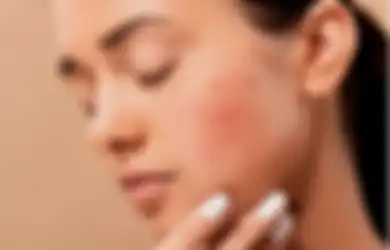 Ternyata Simpel! Ini 5 Langkah Tepat Biar Wajah Terbebas dari Jerawat!