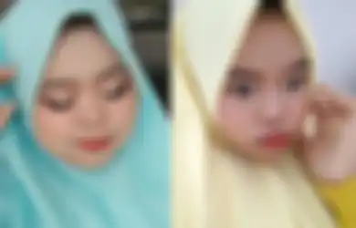 Tampil Beda Pasca Permak Wajah, Kekeyi Tegaskan Pilih Filler Hidung Bukan Karena Tak Pede Melainkan Gara-gara Hal Ini: Sebenarnya...
