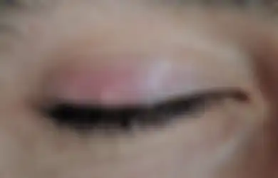 Mata Bintitan? Enggak Bersihkan Make-Up dan 3 Hal Ini Penyebabnya!