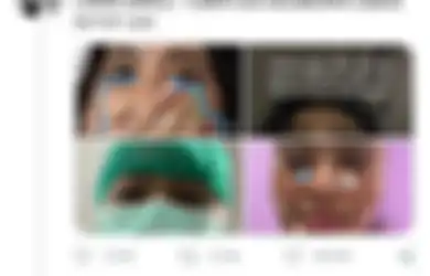 Viral Seorang Wanita Tak Bisa Menutup Rahangnya Usai Menguap, Ternyata Ini Penyebabnya