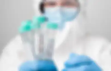Mengapa Harga Tes PCR Melambung Tinggi Sejak Awal Pandemi? Terungkap Alasan Akhirnya Baru Kini Bisa Diturunkan, Ini Kata Kemenkes