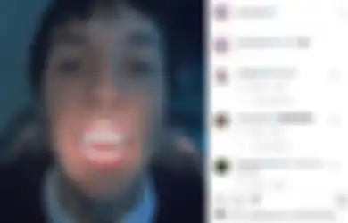 Serem Atau Keren? Oli Sykes Modifikasi Gigi Taringnya Jadi Mirip Vampir