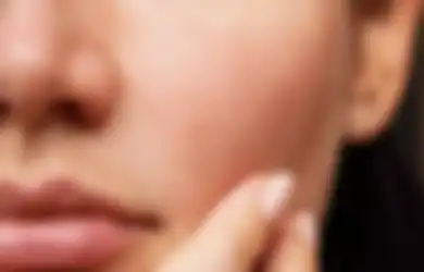 Biar Pori-pori Wajah Enggak Membesar, Coba 5 Cara dari Dermatologist Buat Mencegahnya!