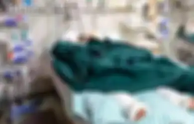 90 Persen Kulitnya Terbakar, Kondisi Pria 19 Tahun Ini Bikin Syok, sang Ibu Sampai Rela Lakukan Hal Ini Demi Anaknya