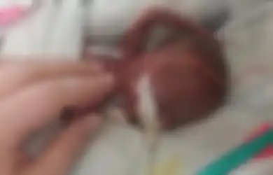 Lahir Prematur Dengan Berat Badan Hanya 0,34 Kg, Bayi Ini Berhasil Pecahkan Rekor Dunia, Nasibnya Kini Sungguh Tak Disangka-sangka
