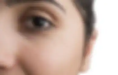 Mengenal Milia, Permasalahan Kulit Wajah yang Kerap Mengganggu Penampilan Para Wanita Serta Berikut Cara Mengatasinya