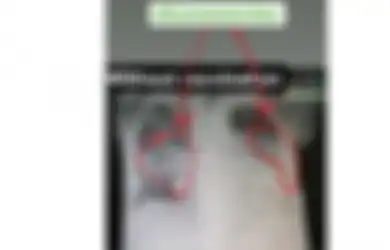Unggah Foto Rontgen Paru-paru Pasien Covid-19 yang Divaksin dan Tidak, Dokter Ini Jelaskan Kondisi Pasien hingga Peringatkan Satu Hal Penting Ini