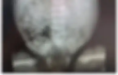 Baru Saja Lahir, Bayi Perempuan Ini Justru Sudah Mengandung Janin Dalam Perutnya, Dokter Syok Usai Temukan Fakta Ini